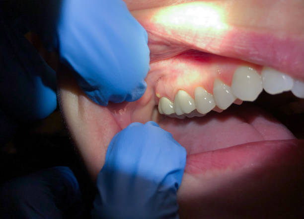 Best Broken Tooth Emergency  in Moore, OK