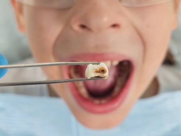 Best Dentist Open on Weekends  in Moore, OK
